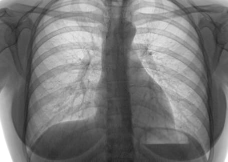Diagnóstico y tratamiento en neumología