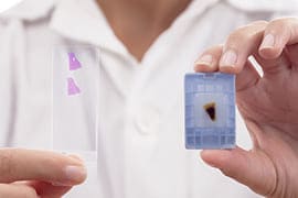 Toma de biopsia de tumor pulmonar 